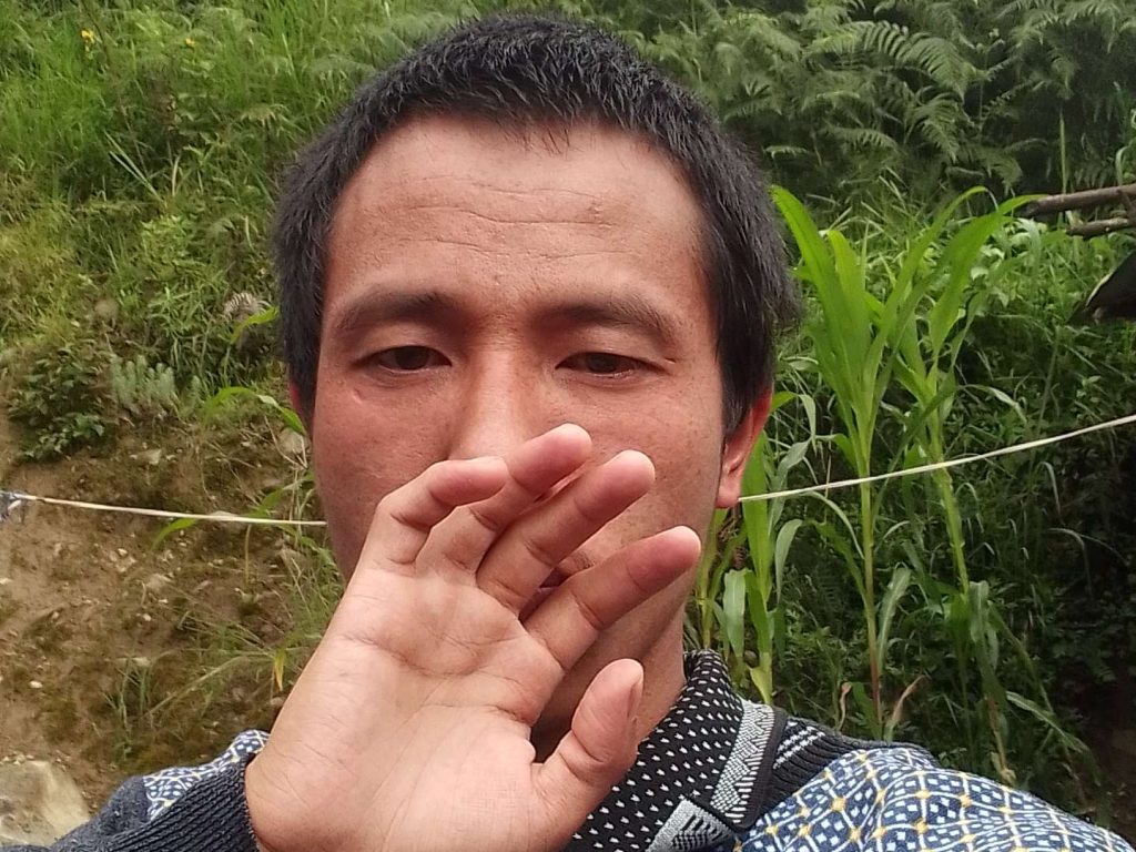 A Man Try to cover his sad face when someone left.